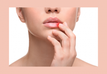 Herpes Simplex e Lisina: un approccio naturale per la cura e la prevenzione dell'Herpes