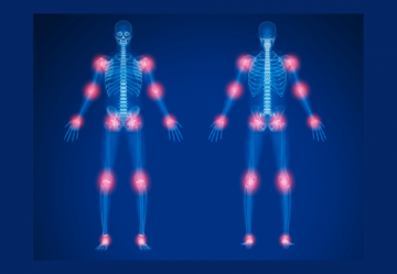 I migliori integratori per la cartilagine
