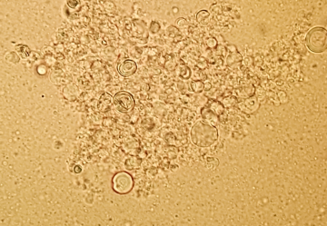 La Vitamina C liposomiale