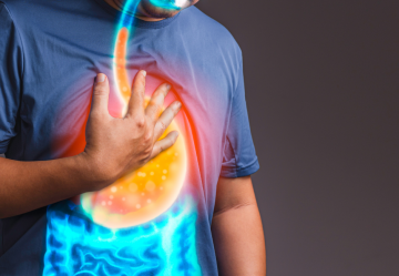 Principi attivi naturali per il controllo del reflusso gastroesofageo