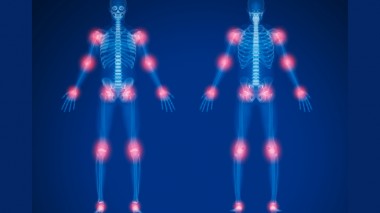 I migliori integratori per la cartilagine